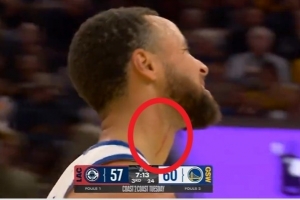 庫(kù)里：血痕是之前打湖人那場(chǎng)留下的 看起來(lái)要比實(shí)際情況嚴(yán)重