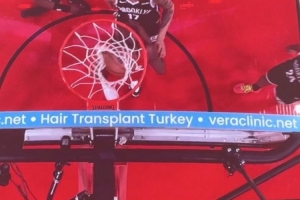 問啥詹姆斯！NBA籃板上沿有土耳其植發(fā)公司廣告 手動@杰倫-布朗