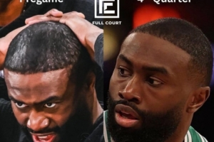 巴克利“建議”杰倫-布朗：當我開始禿頭時 我立馬就決定剃光！