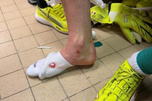 舍瓦利耶談被踢傷：有時候有些動作必須避免，今天我算是非常幸運