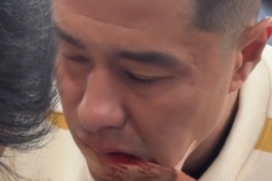 硬漢！國安足協(xié)杯奪冠后，侯森在場(chǎng)邊默默處理嘴部傷口